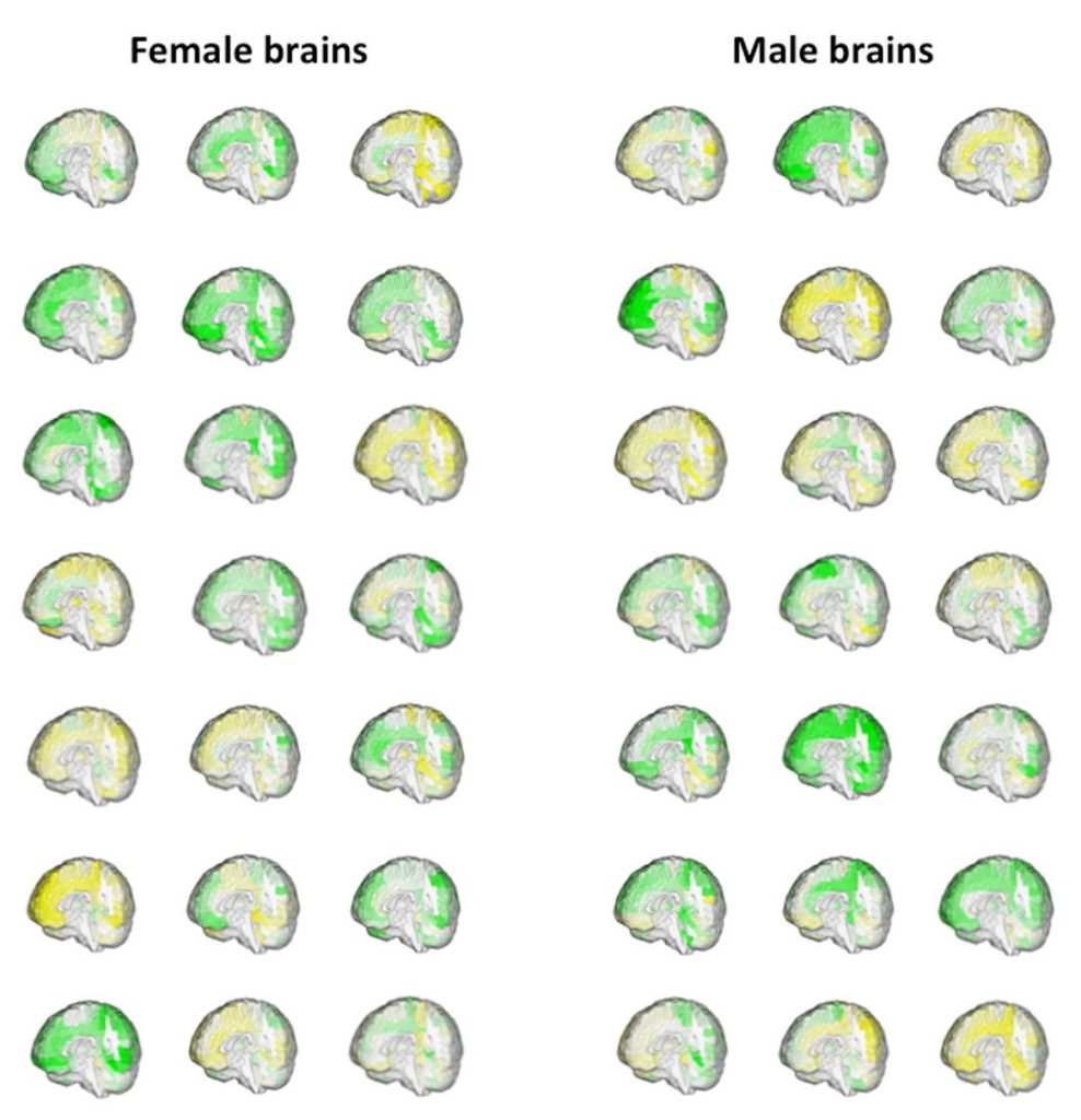 Study Reveals The Differences Between Men And Women's Brains (Video ...