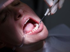 Woman with periodontal disease