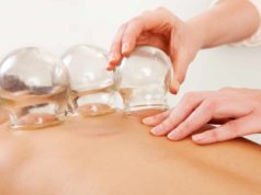 cupping