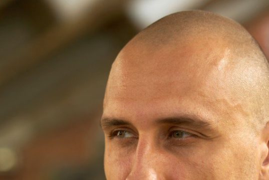 Be Bald And Free Day