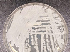 fungus