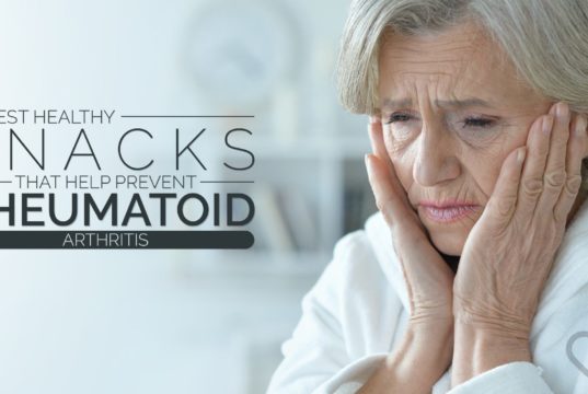rheumatoid arthritis