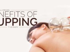 cupping