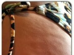 cellulite