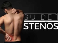 stenosis