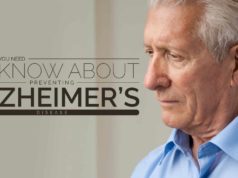 alzheimers