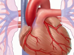 heart disease