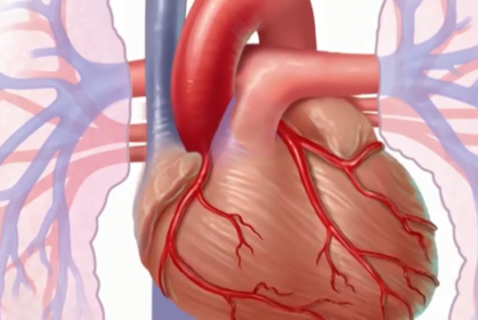 heart disease