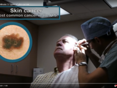 skin cancer