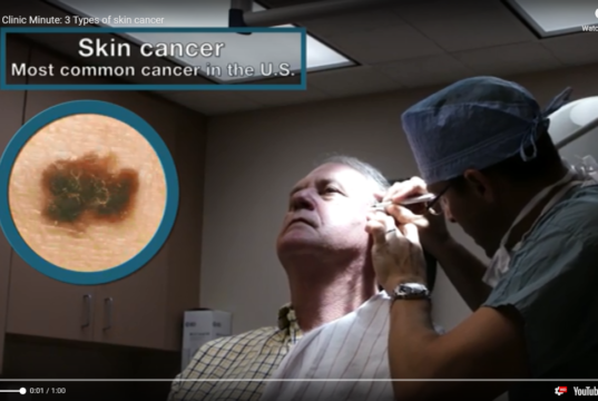 skin cancer