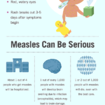 measles-infographic