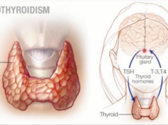 Thyroid