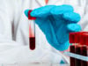 freepik/doctor-s-hands-blue-gloves-keep-test-tube-with-blood_93675-69701