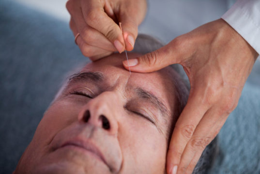 https://www.freepik.com/premium-photo/senior-man-receiving-head-massage-from-physiotherapist_8446358.htm#query=senior%20acupuncture&position=1