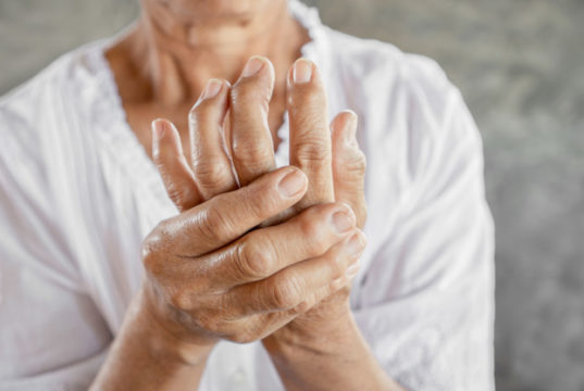 https://www.freepik.com/premium-photo/woman-showing-hand-fingers-problem-gout_6775978.htm#page=1&query=hand%20arthritis&position=2