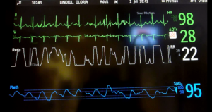 https://www.storyblocks.com/video/stock/heart-monitor-in-icu-sguqqvnjrjwzghgtm