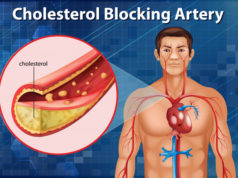https://www.freepik.com/free-vector/diagram-showing-cholesterol-blocking-artery-human-body_8145456.htm#page=1&query=cholesterol&position=1