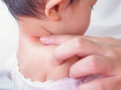 https://www.freepik.com/premium-photo/mother-applying-antiallergic-cream-baby-neck-with-skin-rash-allergy-with-red-spot-cause-by-mosquito-bite_11735236.htm?query=bug%20bites