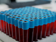 https://www.freepik.com/free-photo/close-up-medical-vacutainers-with-blood-tray_17009862.htm?query=blood%20lab