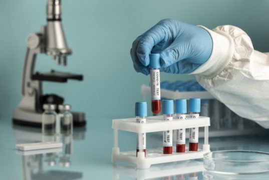 https://www.freepik.com/free-photo/hand-with-protective-gloves-holding-blood-samples-covid-test_13911935.htm#page=1&query=covid%20lab&position=6
