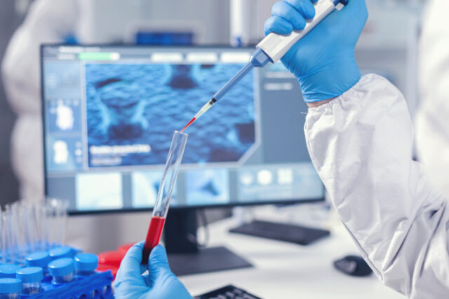 medical-researcher-dripping-blood-into-test-tube-from-micropipette-doctor-working-with-various-bacteria-tissue-pharmaceutical-research-antibiotics-against-covid19 https://www.freepik.com/free-photo/medical-researcher-dripping-blood-into-test-tube-from-micropipette-doctor-working-with-various-bacteria-tissue-pharmaceutical-research-antibiotics-against-covid19_16781876.htm?query=covid%20lab