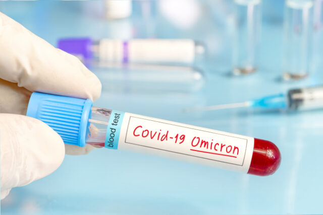 https://www.freepik.com/premium-photo/doctor-with-positive-blood-sample-new-variant-detected-coronavirus-strain-called-covid-omicron-research-new-african-strains-mutations-covid-19-coronavirus-laboratory_20889699.htm#page=1&query=omicron&position=3&from_view=search