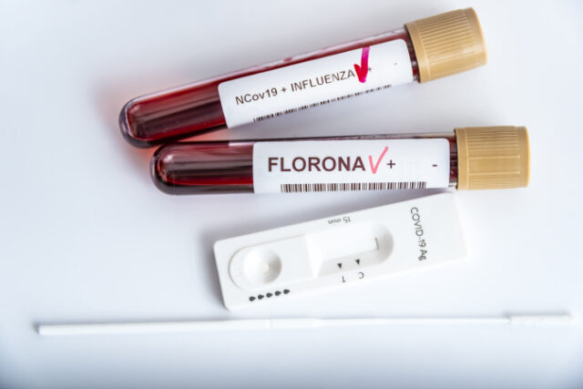 blood-samples-new-variant-omicron-plus-flu-fluorone-covid19-coronavirus-selective-approach-sample-tube https://www.freepik.com/premium-photo/blood-samples-new-variant-omicron-plus-flu-fluorone-covid19-coronavirus-selective-approach-sample-tube_22165271.htm#query=flurona&position=8&from_view=search