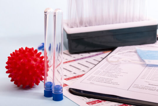 https://www.freepik.com/premium-photo/several-laboratory-objects-analysis_7404143.htm?query=covid%2019
