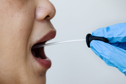 https://www.freepik.com/free-photo/woman-getting-mouth-swab-test-coronavirus_11303666.htm#query=covid%20swab&position=11&from_view=search