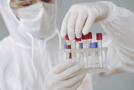 https://www.freepik.com/free-photo/man-protective-suit-glasses-working-laboratory_8355516.htm#query=blood%20test&position=15&from_view=search
