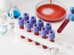 https://www.freepik.com/free-photo/coronavirus-vaccine-lab-with-samples_13436599.htm#query=blood%20test&position=1&from_view=search
