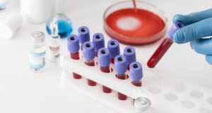 https://www.freepik.com/free-photo/coronavirus-vaccine-lab-with-samples_13436599.htm#query=blood%20test&position=1&from_view=search