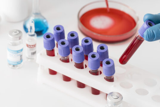 https://www.freepik.com/free-photo/coronavirus-vaccine-lab-with-samples_13436599.htm#query=blood%20test&position=1&from_view=search