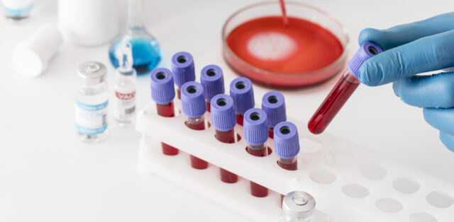 https://www.freepik.com/free-photo/coronavirus-vaccine-lab-with-samples_13436599.htm#query=blood%20test&position=1&from_view=search