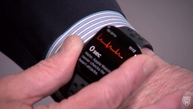 Smartwatch