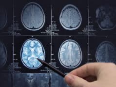 https://www.vecteezy.com/photo/3823145-brain-research-magnetic-resonance-imaging