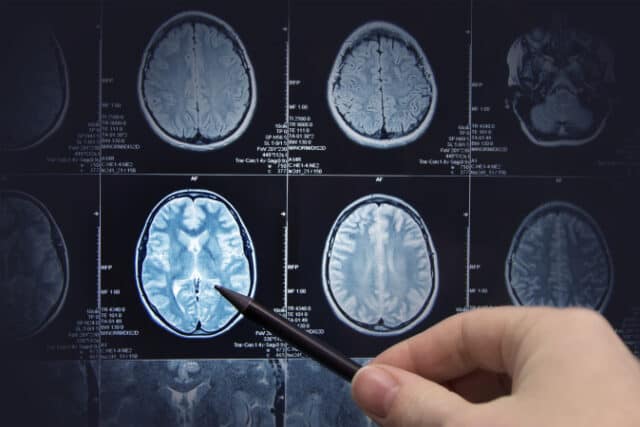 https://www.vecteezy.com/photo/3823145-brain-research-magnetic-resonance-imaging