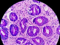 https://www.vecteezy.com/photo/4907286-photomicrograph-of-rectal-cancer-microscopic-slide-view-ibd-ibs-close-up