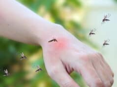 https://www.freepik.com/premium-photo/mosquitoes-bite-adult-hand-made-skin-rash-allergy-with-red-spot_19871029.htm#query=mosquito%20itch&position=4&from_view=search