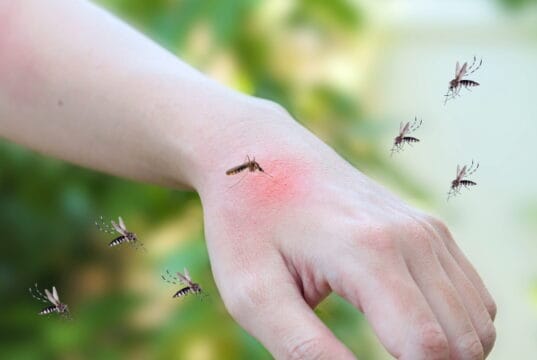 https://www.freepik.com/premium-photo/mosquitoes-bite-adult-hand-made-skin-rash-allergy-with-red-spot_19871029.htm#query=mosquito%20itch&position=4&from_view=search