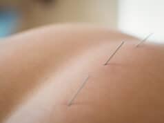 https://www.freepik.com/free-photo/close-up-patient-getting-dry-needling_8405510.htm#query=acupuncture&position=44&from_view=search