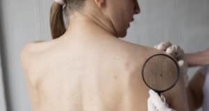 https://www.freepik.com/free-photo/female-doctor-diagnosing-melanoma-body-female-patient_25169044.htm?query=melanoma