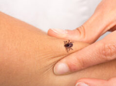 https://www.freepik.com/premium-photo/tick-that-is-biting-arm-girl_27082743.htm#query=lyme%20disease&position=46&from_view=search