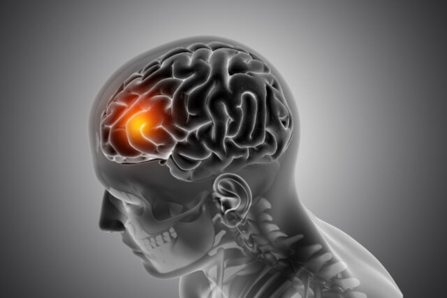 https://www.freepik.com/free-photo/male-medical-figure-with-front-brain-highlighted_7061148.htm#page=3&query=brain&position=9&from_view=search&track=sph