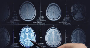 https://www.vecteezy.com/photo/3823145-brain-research-magnetic-resonance-imaging