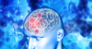 https://www.freepik.com/free-photo/3d-medical-background-with-brain-highlighted_4619833.htm#query=dementia&position=41&from_view=search&track=sph