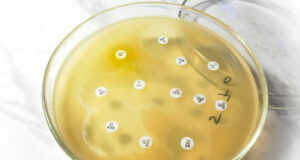 https://www.freepik.com/premium-photo/antimicrobial-susceptibility-testing-petri-dish-antibiotic-resistance-bacteria_33863221.htm#query=antimicrobial%20resistance&position=16&from_view=search&track=sph
