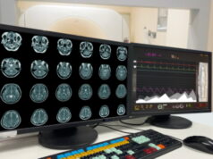 https://www.freepik.com/premium-photo/motion-blur-medical-ct-mri-pet-brain-scan-film-computer-monitor-technologically-advanced-functional-medical-office_30415062.htm#query=PET%20scan&position=13&from_view=search&track=sph
