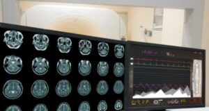 https://www.freepik.com/premium-photo/motion-blur-medical-ct-mri-pet-brain-scan-film-computer-monitor-technologically-advanced-functional-medical-office_30415062.htm#query=PET%20scan&position=13&from_view=search&track=sph