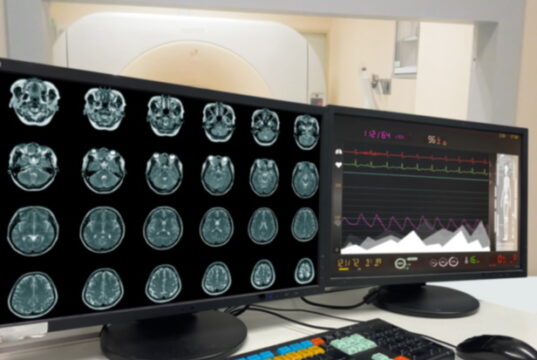 https://www.freepik.com/premium-photo/motion-blur-medical-ct-mri-pet-brain-scan-film-computer-monitor-technologically-advanced-functional-medical-office_30415062.htm#query=PET%20scan&position=13&from_view=search&track=sph